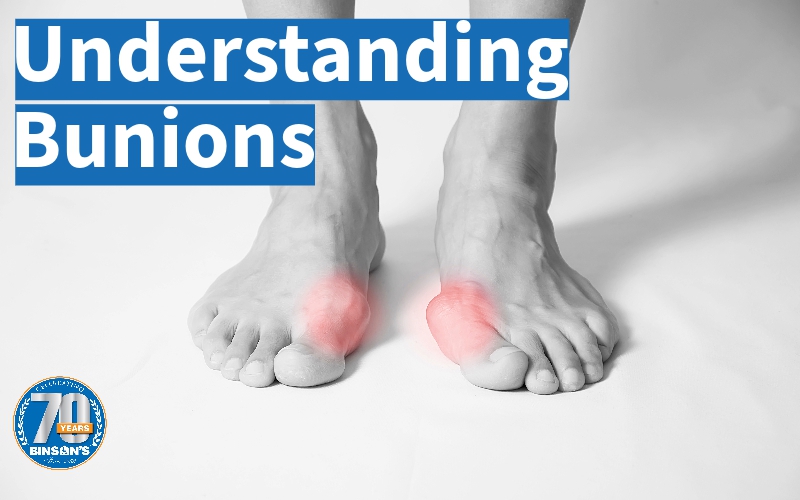 Understanding Bunions: Causes, Symptoms, and Effective Relief