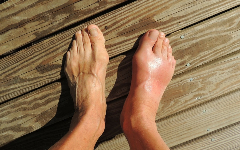 6 Tips To Protect The Health Of Your Feet With Diabetes