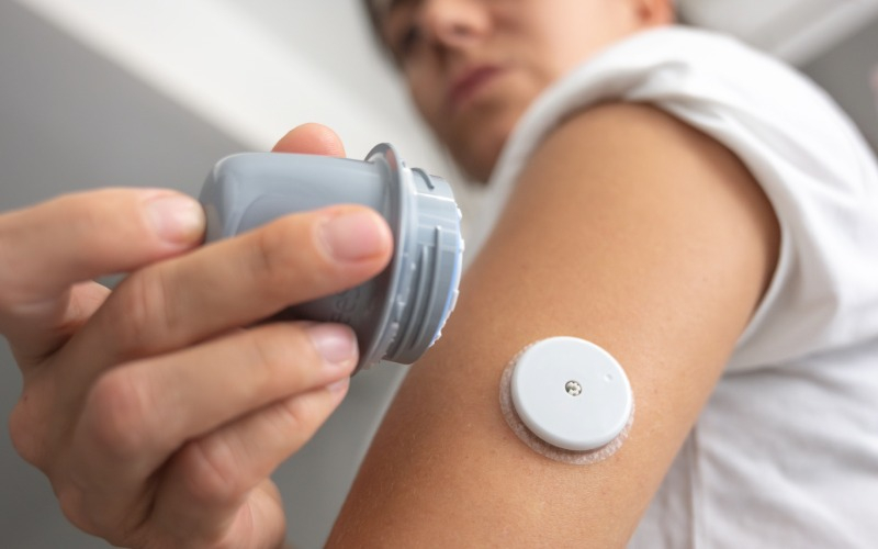 A close-up view of a person with a diabetes CGM sensor applied to the back of their upper arm, holding the grey applicator device nearby.