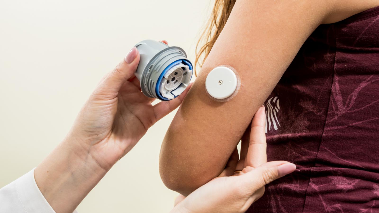 Person applying a Continuous Glucose Monitor (CGM) sensor