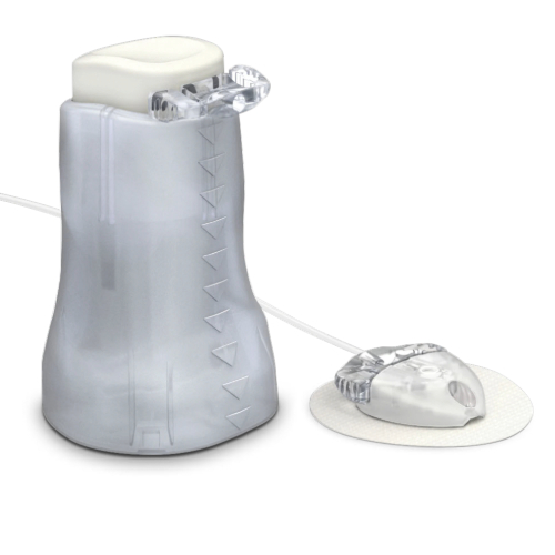 Mio Advanced Infusion Set